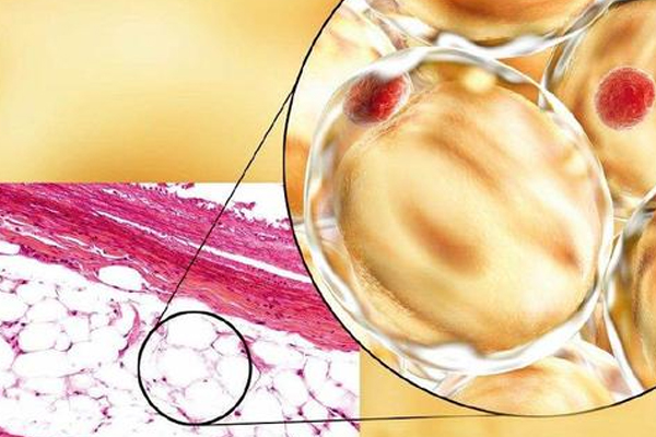 脂肪干细胞储存