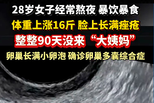 28 岁女子熬出多囊卵巢！干细胞治疗：给卵巢 “回春” 的新可能